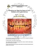 Smoking can Mask the Signs of Gum disease until it gets serious (22/03/2026 - The STAR)